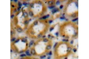 Used in DAB staining on fromalin fixed paraffin-embedded Kidney tissue (Kallikrein 1 抗体  (AA 25-261))