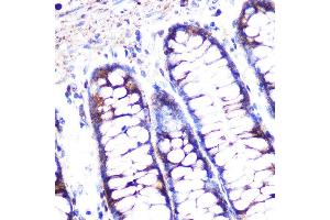 Confocal immunofluorescence analysis of Raw264. (Caspase 1 抗体  (AA 1-311))