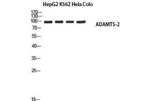 Western Blot (WB) analysis of HepG2 K562 HeLa Colo using ADAMTS-2 antibody. (Adamts2 抗体)