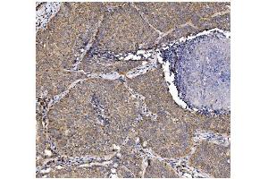 IHC analysis of PFKFB2 using anti-PFKFB2 antibody (ABIN7601627). (PFKFB2 抗体  (AA 4-505))