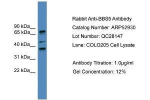 WB Suggested Anti-BBS5  Antibody Titration: 0. (BBS5 抗体  (N-Term))