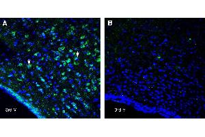 Expression of NPFFR1 in rat hypothalamusImmunohistochemical staining of perfusion-fixed frozen rat brain sections with Anti-Neuropeptide FF Receptor 1 (extracellular) Antibody (ABIN7581921), (1:400), followed by goat anti-rabbit-AlexaFluor-488.