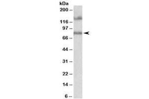 Western blot testing of human hippocampus lysate with EPB41L5 antibody at 1ug/ml. (EPB41L5 抗体)