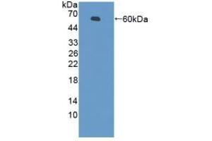 Detection of Recombinant PZP, Mouse using Polyclonal Antibody to Pregnancy Zone Protein (PZP) (PZP 抗体  (AA 1224-1495))