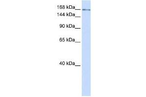 IFT172 antibody used at 0. (IFT172 抗体  (N-Term))