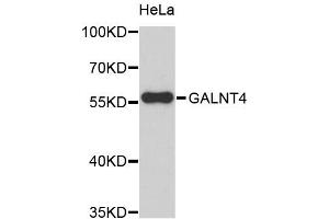 Western blot analysis of extracts of HeLa cells, using GALNT4 antibody (ABIN5972364). (GALNT4 抗体)