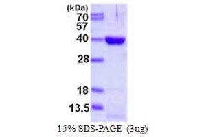 DIM1 Dimethyladenosine Transferase 1 Homolog (DIMT1) (AA 1-313) protein (His tag)