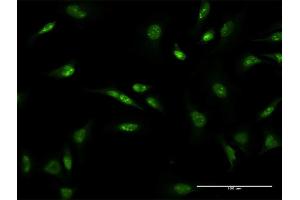 Immunofluorescence of monoclonal antibody to D4S234E on HeLa cell. (NSG1 抗体  (AA 1-185))