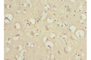 Immunohistochemistry of paraffin-embedded human brain tissue using ABIN7165996 at dilution of 1:100 (PRUNE2 抗体  (AA 1-250))