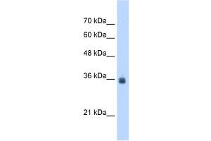SDF4 antibody used at 2. (SDF4 抗体  (C-Term))