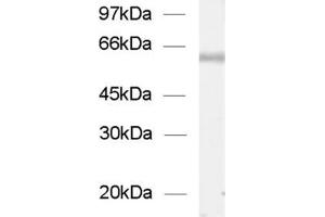 dilution: 1 : 1000, sample: enriched vesicles from rat spinal chord (ChT 抗体  (AA 501-580))