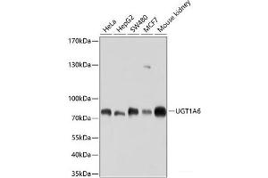Western blot analysis of extracts of various cell lines using UGT1A6 Polyclonal Antibody at dilution of 1:1000. (UGT1A6 抗体)