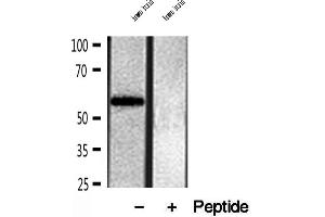 Western blot analysis of extracts of human brain tissue, using OXCT1 antibody. (OXCT1 抗体  (Internal Region))