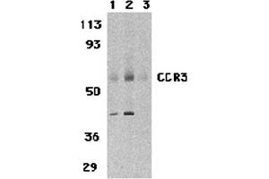 Western Blotting (WB) image for anti-Chemokine (C-C Motif) Receptor 3 (CCR3) (N-Term) antibody (ABIN1031307) (CCR3 抗体  (N-Term))