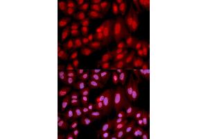 Immunofluorescence analysis of U2OS cells using PPP2R2A antibody (ABIN6291584). (PPP2R2A 抗体)