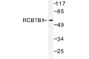 Image no. 1 for anti-Regulator of Chromosome Condensation (RCC1) and BTB (POZ) Domain Containing Protein 1 (RCBTB1) antibody (ABIN271804) (RCBTB1 抗体)