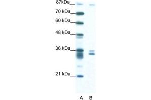Western Blotting (WB) image for anti-PBX/knotted 1 Homeobox 2 (PKNOX2) antibody (ABIN2460704) (PKNOX2 抗体)