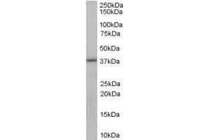 ABIN185332 (0. (SORD 抗体  (C-Term))