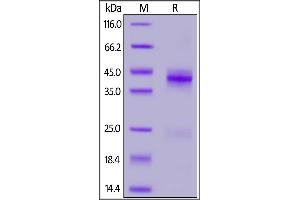 SDS-PAGE (SDS) image for Connective Tissue Growth Factor (CTGF) (AA 27-349) (Active) protein (His tag) (ABIN7013453)