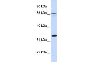WB Suggested Anti-PSIP1 Antibody Titration:  0. (PSIP1 抗体  (Middle Region))
