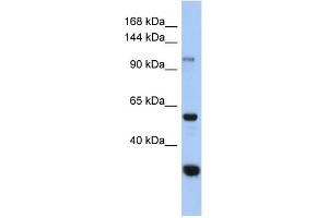 WB Suggested Anti-GANC Antibody Titration: 0. (GANC 抗体  (Middle Region))