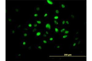 Immunofluorescence (IF) image for anti-Survival Motor Neuron Domain Containing 1 (SMNDC1) (AA 1-238) antibody (ABIN523696)