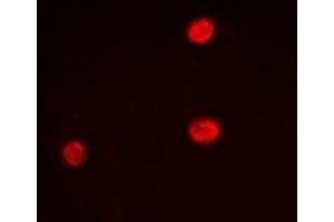 Immunofluorescent analysis of LRH-1 staining in Hela cells. (P2RX5 抗体)