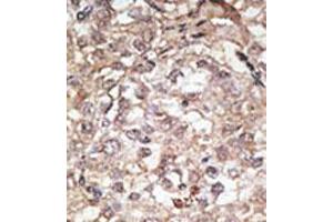 Image no. 2 for anti-Toll-Like Receptor 1 (TLR1) (C-Term) antibody (ABIN357041) (TLR1 抗体  (C-Term))