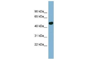 WB Suggested Anti-EFCAB4B Antibody Titration:  0. (EFCAB4B 抗体  (N-Term))