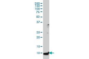 S100A6 monoclonal antibody (M16), clone 6D1 Western Blot analysis of S100A6 expression in HeLa . (S100A6 抗体  (AA 18-90))