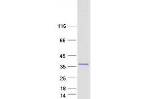 Western Blotting (WB) image for Growth Arrest-Specific 2 (GAS2) (Transcript Variant 1) protein (Myc-DYKDDDDK Tag) (ABIN2721694)