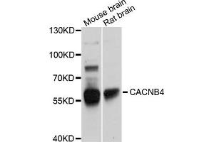 Western blot analysis of extracts of various cells, using CACNB4 antibody. (CACNB4 抗体)