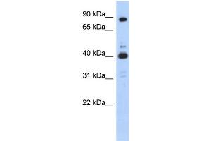 WB Suggested Anti-CDK9 Antibody Titration:  0. (CDK9 抗体  (N-Term))