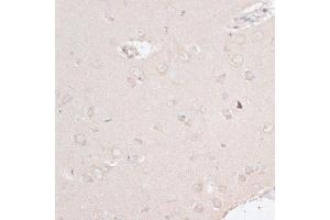 Immunohistochemistry of paraffin-embedded rat brain using ABCF2 antibody (ABIN6291735) at dilution of 1:100 (40x lens). (ABCF2 抗体)