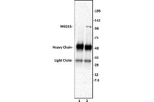 MED15 antibody (pAb) tested by Immunoprecipitation. (MED15 抗体  (C-Term))