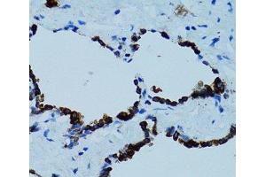 Immunohistochemistry of paraffin-embedded Human lung using CTSE Polyclonal Antibody at dilution of 1:100 (40x lens). (Cathepsin E 抗体)