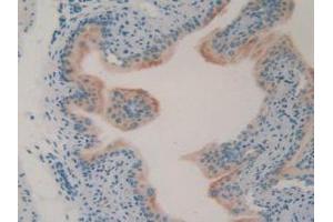 IHC-P analysis of Mouse Vas deferens Tissue, with DAB staining.