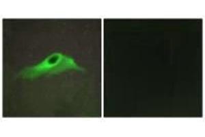 Immunofluorescence analysis of HeLa cells, using Collagen IV α5 antibody. (COL4a5 抗体)