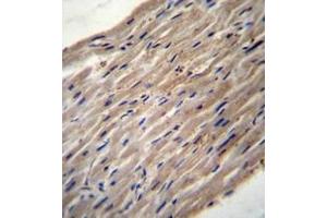 Immunohistochemistry analysis in formalin fixed and paraffin embedded human heart tissue reacted with PLOD1 / PLOD Antibody (N-term) followed which was peroxidase conjugated to the secondary antibody and followed by DAB staining. (PLOD1 抗体  (N-Term))