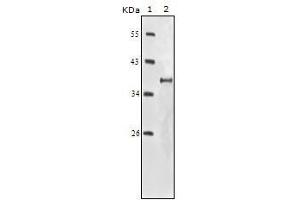 Western blot analysis using IGF1R-Beta mouse mAb against truncated IGF1R-Beta recombinant protein. (IGF1R-beta 抗体)