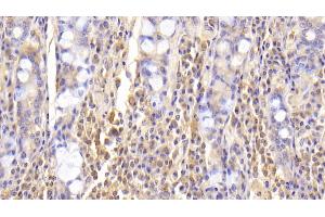 Immunohistochemistry (IHC) image for anti-Arginyl-tRNA Synthetase (RARS) (AA 1-146) antibody (ABIN7426574)