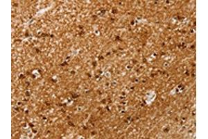 The image on the left is immunohistochemistry of paraffin-embedded Human brain tissue using ABIN7192664(SSX4 Antibody) at dilution 1/20, on the right is treated with synthetic peptide. (SSX4 抗体)