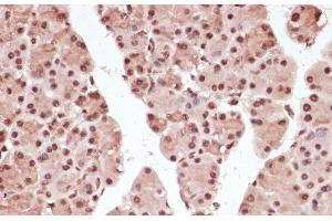 Immunohistochemistry of paraffin-embedded Rat pancreas using Phospho-ATF2(T71) Polyclonal Antibody at dilution of 1:100 (40x lens).