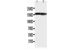 Anti-Collagen II antibody, Western blotting Lane 1: Rat Heart Tissue Lysate Lane 1: Rat Brain Tissue Lysate (COL2A1 抗体  (C-Term))