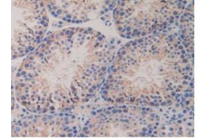 IHC-P analysis of Mouse Testis Tissue, with DAB staining. (PDGFRB 抗体  (AA 337-583))