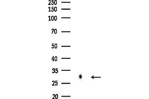 Western blot analysis of lysates from Hela cells(heat-shock,45 min treatment), using HLA-DOB Antibody at 1/1000 dilution.