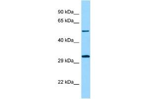 WB Suggested Anti-STK33 Antibody Titration: 1. (STK33 抗体  (N-Term))