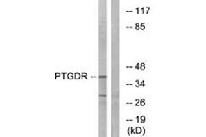 Western blot analysis of extracts from HepG2 cells, using PTGDR Antibody. (PTGDR 抗体  (AA 263-312))