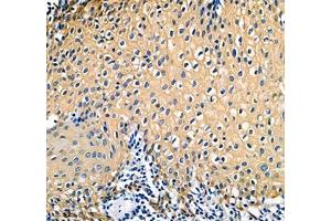 Immunohistochemistry of paraffin embedded human tonsil using IFIT5 (ABIN7074334) at dilution of 1:500 (300x lens) (IFIT5 抗体)
