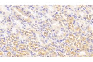 Detection of PKLR in Mouse Kidney Tissue using Polyclonal Antibody to Pyruvate kinase isozymes R/L (PKLR) (PKLR 抗体  (AA 114-323))